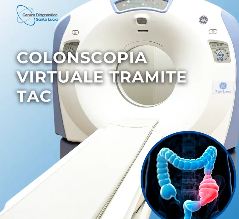 Colonscopia virtuale