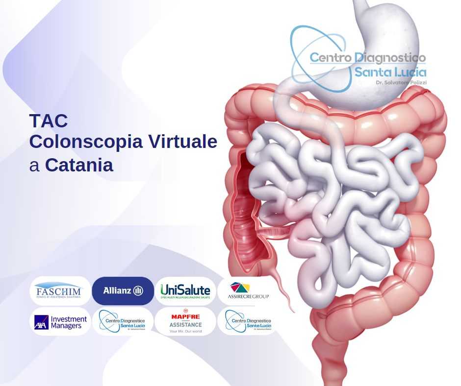 TAC Colonscopia Virtuale a Catania
