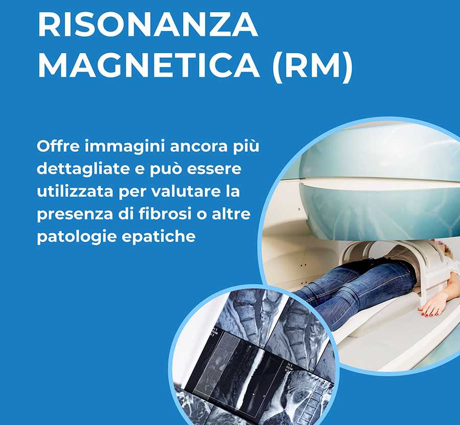 Risonanza Magnetica Catania