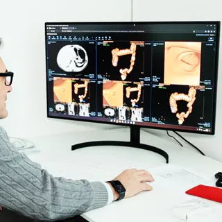 Colonscopia Virtuale