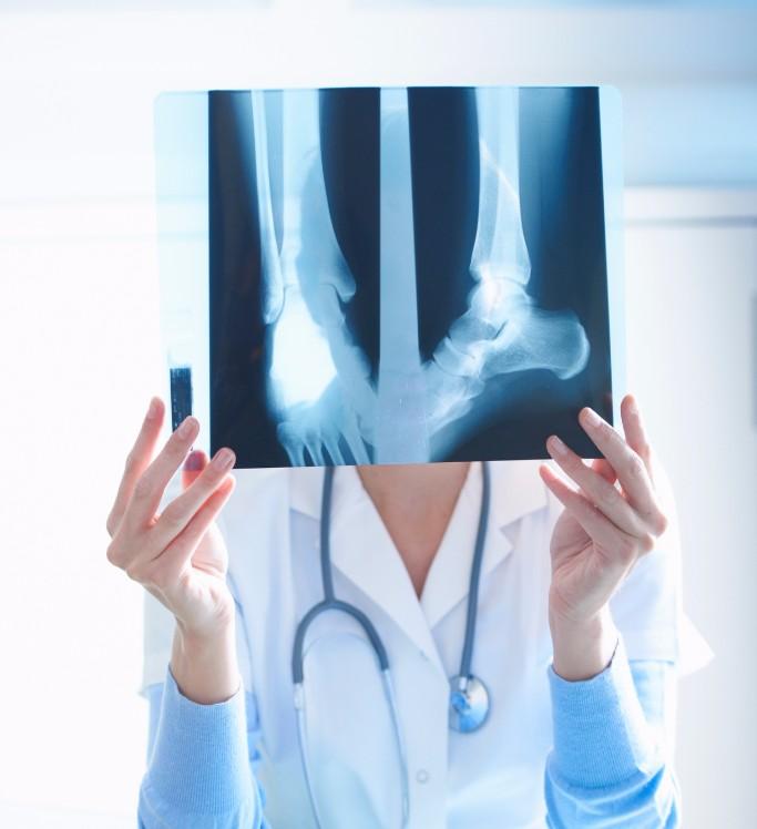 Osteoporosi